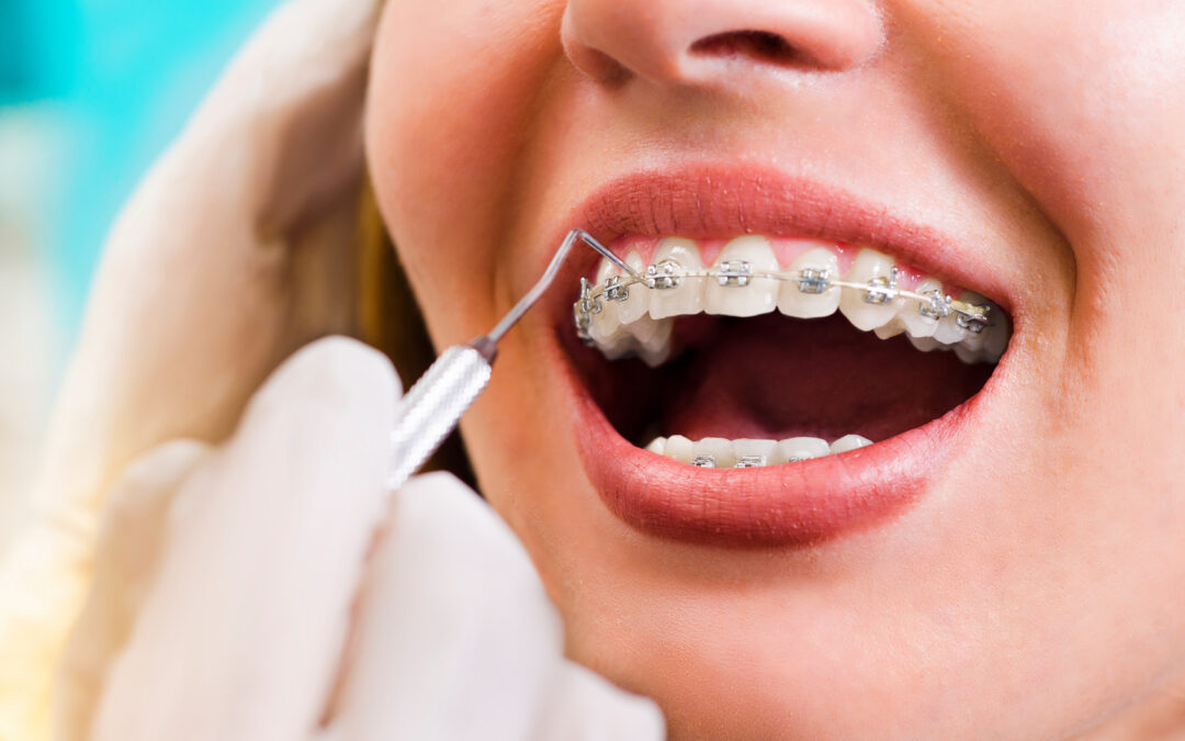 The Consequences of Ignoring Orthodontic Problems